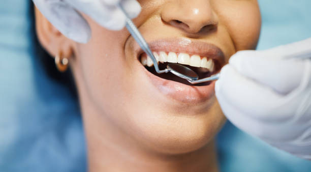 Best Emergency Dental Extractions in Doctor Phillips, FL